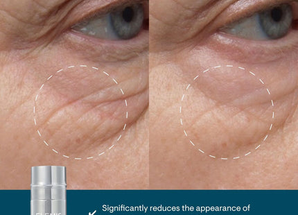 V2HB272E56F826E891337C769A9529555EDR7706327P1