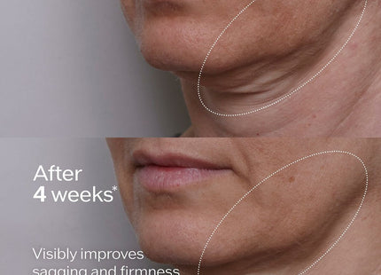 V3HEA7A5CF61F3192A0DBB26E859A8C927ER6241437P5