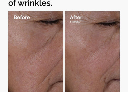 V2HF67E4C72BF968AAB588E4F85969EDD2DR7415509P3