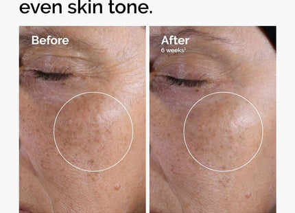 V3H1CAC84579BD1FE6DE1547D494C18DBEER7586623P3