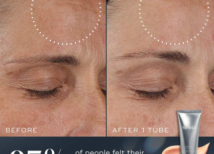 V4H0424F618DDCAE27143FD8235105235DFR7415658P5