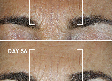 V2H1A2D5A501A85BE3762EDC22B29A34186R7545407P5