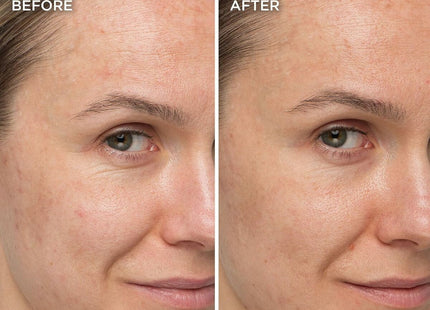 V4H2538BD4D231B64FD2B13A87EE4B5155FR7196049P3