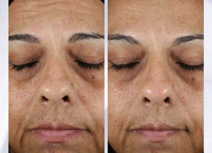 V3HBBDABF4557BD9CED52DFA459CC7FAE5BR5608209P2