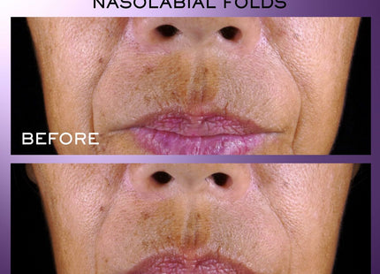 V3H33BC4C2A0A6BBC2E6F7A4D9515DC17F5R6240763P4