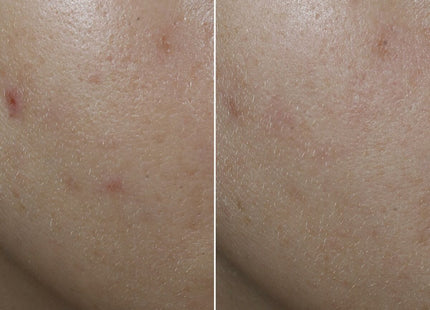 V3H2D2A68ADE1679B8DE59D3FD689A47C8ER7196241P6