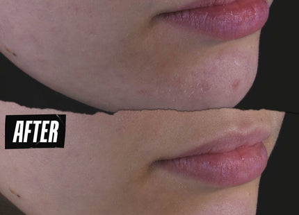 V2H1595690C66CA3590C04B9BBB23560CAAR7660223P6