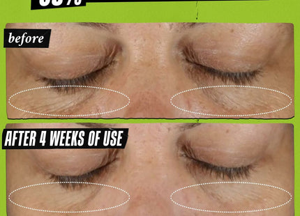 V2H34AC1FB8A2CF9E56DE6C7F92AC7FDA1DR7659704P6