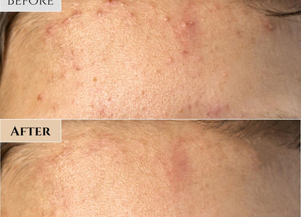 V2HA8085F716AF828FB8CA9EE517E7F0B55R7528333P8